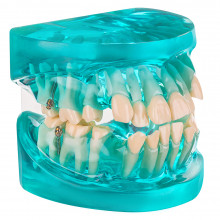 Демонстрационная модель Revyline "Зубы" с ортодонтическими имплантами в Санкт-Петербурге