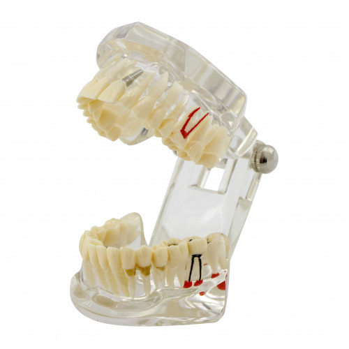 Демонстрационная модель Revyline ТМ-105 "Зубы", белая