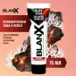 Зубная паста Blanx Black Volcano, 75 мл